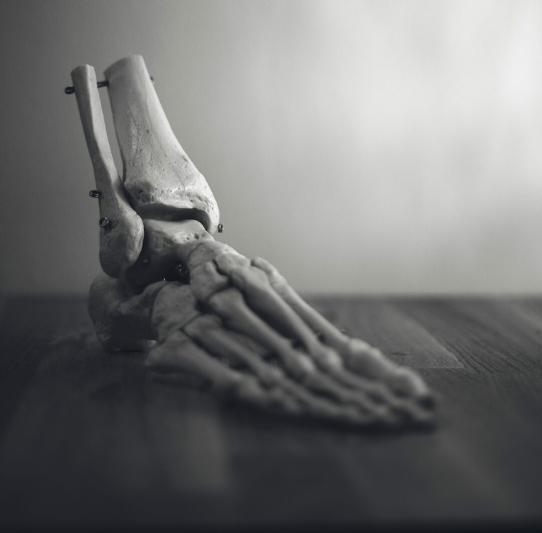 Why does my ankle hurt?